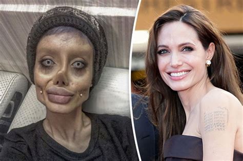 Teenager Has Extreme Plastic Surgery To Look Like Angelina Jolie Extreme Plastic Surgery