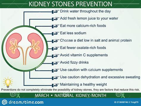 Kidney Stones Prevention Infographic Vector Illustration Stock Vector