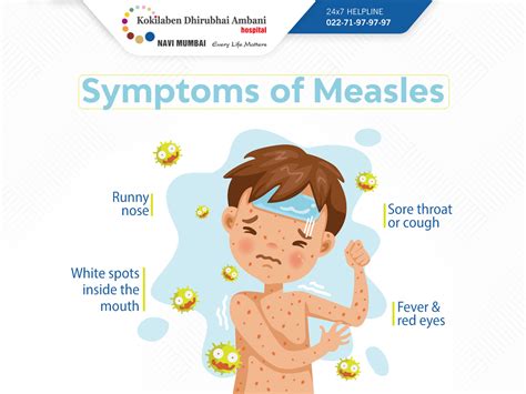 Symptoms Of Measles