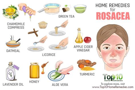 Home Remedies For Rosacea Top 10 Home Remedies