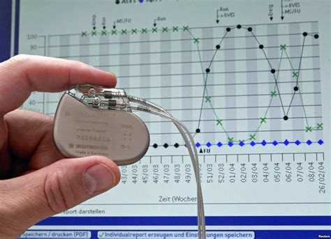 New Pacemaker Generates Electricity From Heartbeats To Power Itself