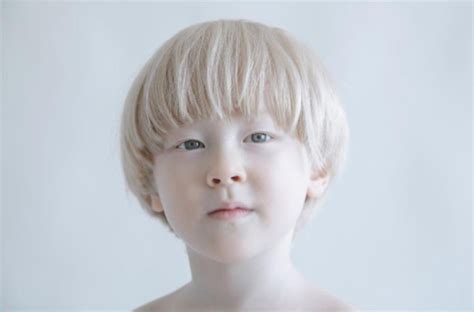 Photographer Captures Stunning Portraits Of Albino People And It S The Most Magical Thing You Ll