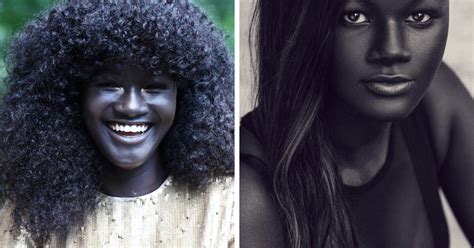 Girl Was Bullied For Her Incredibly Dark Skin Now She Became A Model