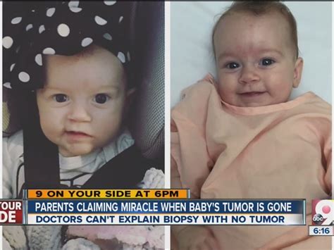 Parents See Miracle When Babys Tumor Vanishes
