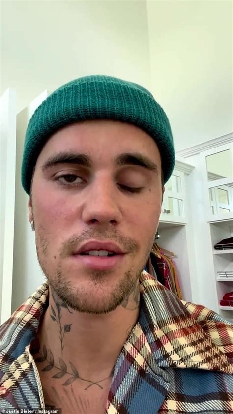 Justin Bieber Reveals He S Been Struck By Facial Paralysis From Ramsay Hunt Syndrome In Shock