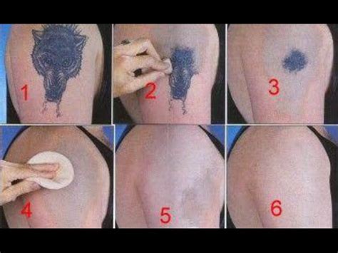 Typically, there are six to eight weeks between your removal sessions. How to Remove a Tattoo without Laser at Home - YouTube