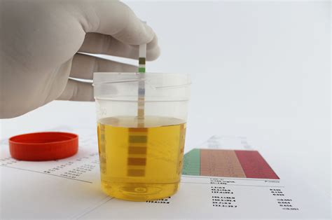 Protein In Urine Symptoms Causes And Treatment