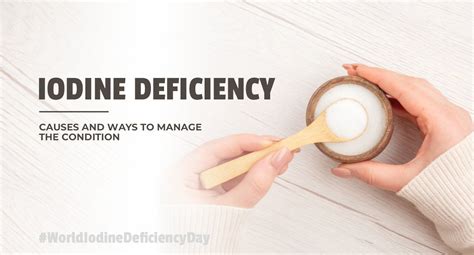 What Is Iodine Deficiency Its Causes And Ways To Manage The Condition