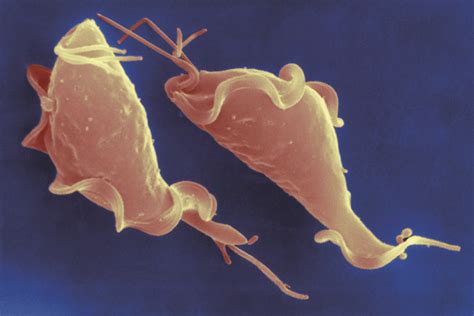 How To Diagnose And Manage Trichomonas Vaginalis The Pharmaceutical