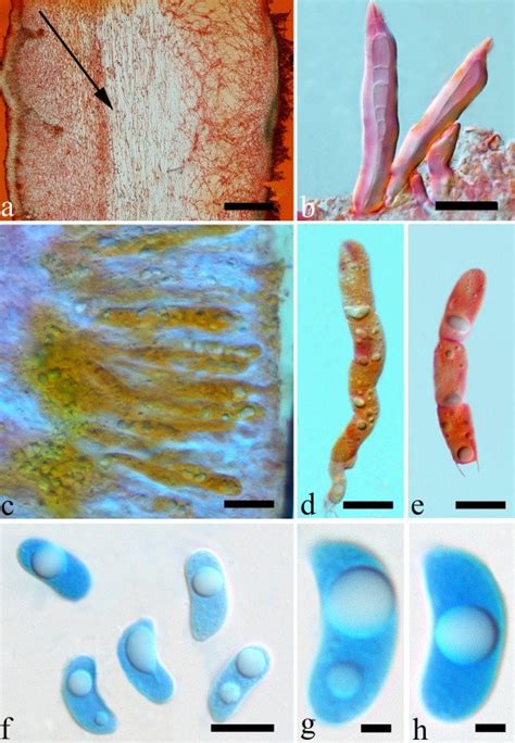 Microscopic Structures Of Auricularia Lateralis Dai 15670 Holotype