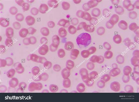 Monocyte Blood Smear Under Microscopy Stock Photo 1114287716 Shutterstock