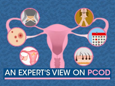 What Is Polycystic Ovary Disease Pcod Causes Symptoms Diagnosis And Treatment