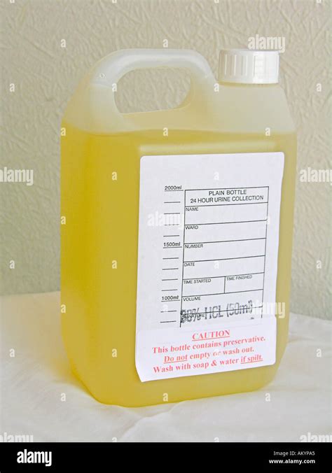 24 Hour Urine Collection Container For Vma Estimation For Testing In