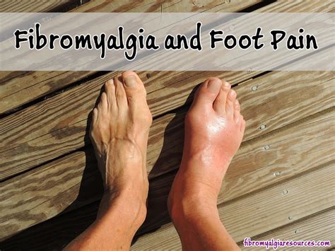 Tips To Control Fibromyalgia Foot Pain Fibromyalgia Resources