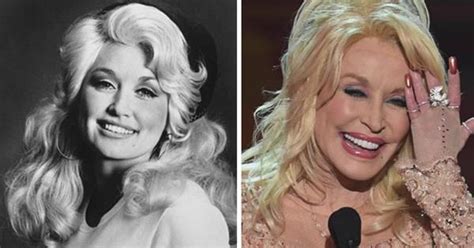 Dolly Partons Plastic Surgery Transformation Now To Love