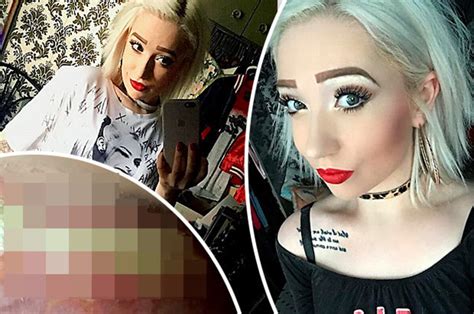 Woman Left With Vagina Burns After Costa Coffee Date Goes Wrong Daily
