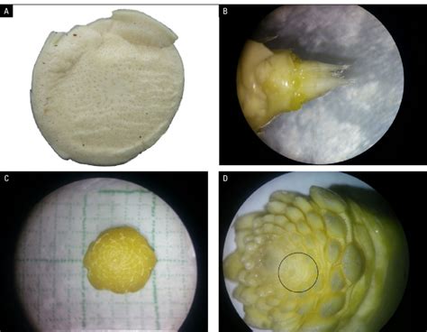 Formation Process And Visualization Of The Deformity In The Pineapple