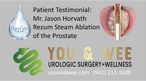 Patient Testmonial Mr Jason Horvath Rezum Steam Ablation Of The Prostate Youtube