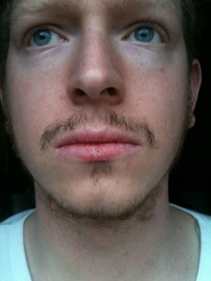 Can you make your hair grow thicker and fuller beard on your face? Struggling with facial hair growth "update" 28 day Pics ...