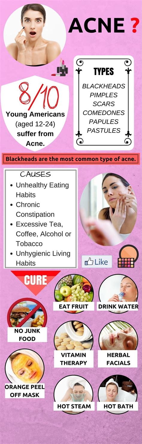 Pin On Acne Remedies Fast