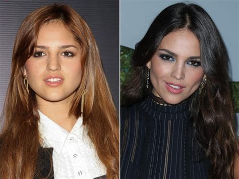 Eiza Gonzálezs Plastic Surgery Before And After Look