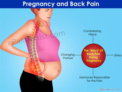 Pregnancy And Back Pain The “whys” And The Remedies