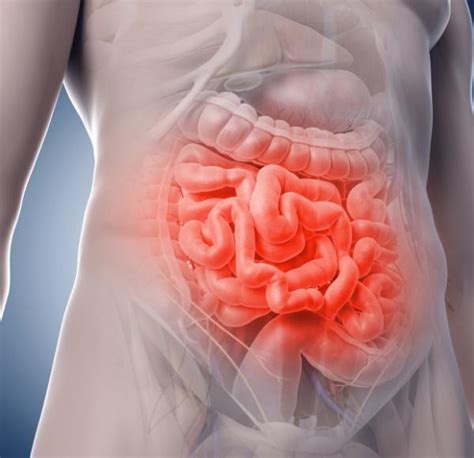 Quali Sono I Sintomi Del Morbo Di Crohn 7 Passi