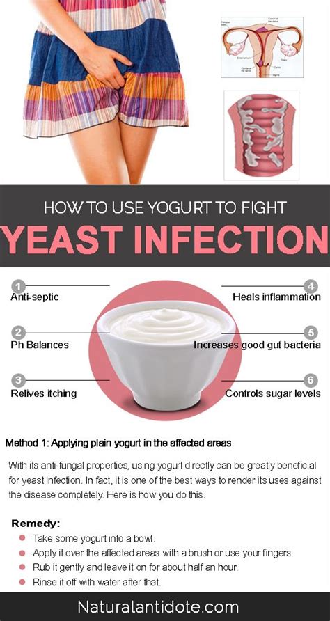 10 Natural Ways To Use Yogurt For Yeast Infections Yeast Infection