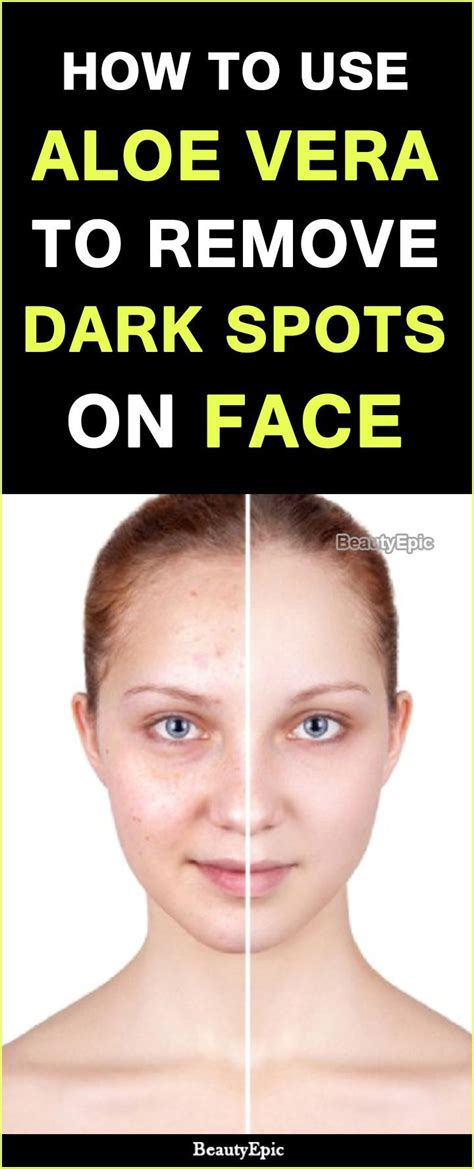 Aloe vera browning is not always caused by too much water. How to Use Aloe Vera to Remove Dark Spots on Face? | Dark ...