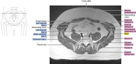 MRI of the male pelvis | Radiology Key