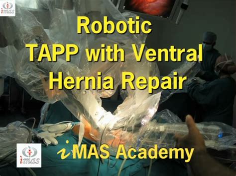 Robotic Tapp With Ventral Hernia Repair By Parveen Bhatia Youtube