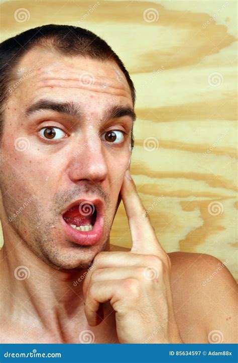 Man With Infected Skin On The Face Stock Image Image Of Epidemic