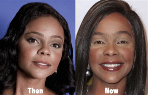 lark voorhies plastic surgery before and after photos latest plastic surgery gossip and news