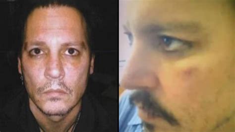 Johnny Depp’s Private Security Guard Shares Photos Of Injuries To The
