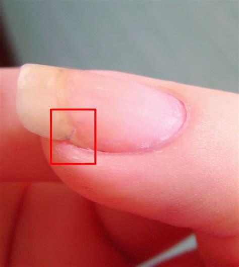 1a 1362×1520 Fix Broken Nail Broken Nails Nails