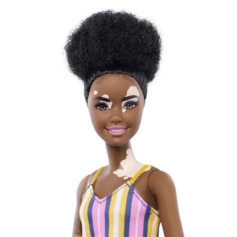 Barbie Unveils New Series Of Diversity Dolls Including One With Skin Condition Vitiligo