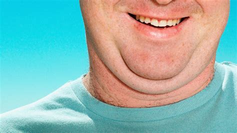 Soon Youll Be Able To Get Rid Of Your Double Chin With An Injection Mirror Online