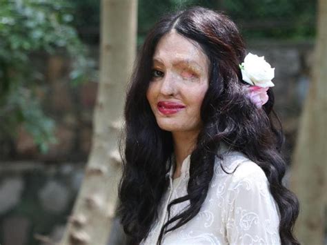11 Things You Didnt Know About Acid Attack Survivor Reshma Qureshi