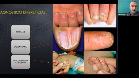 Webinar C Mo Manejo Las Patolog As Dermatol Gicas M S Frecuentes