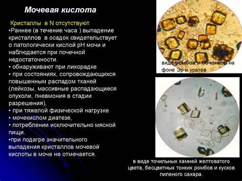 Диета для снижения мочевая кислота Мочевая Кислота Стала В Норме Какая Диета – Telegraph Мочевая Кислота Стала В Норме Какая Диета – Telegraph Диета для снижения мочевая кислота