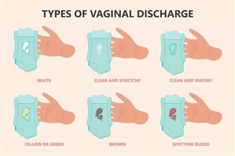 Is White Discharge Before Period Sign Of Pregnancy Best Causes Of