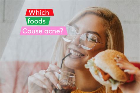 Which Food Causes Acne Mdacne