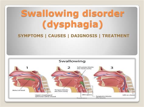 Swallowing Disorder Dysphagia In Children Causes Symptoms Diagno