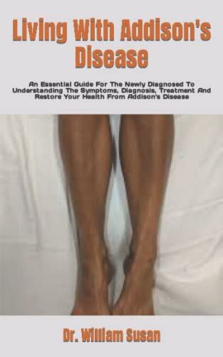 Living With Addisons Disease An Essential Guide For The Newly