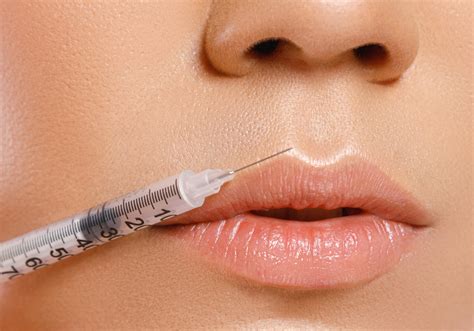 Best Lip Injections Dermal Fillers Mclean Cosmetic Dermatology Center