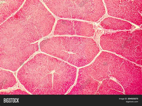 Light Micrograph Liver Image And Photo Free Trial Bigstock