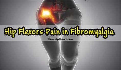 Hip Flexors Pain In Fibromyalgia And Its Management Fibromyalgia