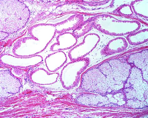 Apocrine Sweat And Sebaceous Glands Photograph By Jose Calvo Science