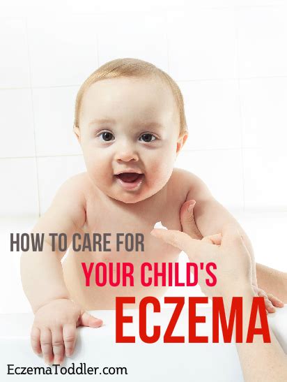 Eczema Is Most Often Seen In Children And Infants When A Child Has