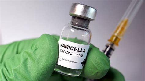 Sarvasya trading (india) private limited. Chickenpox Vaccine Changes the Face of Common Childhood ...